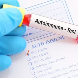 Choroby autoimmunologiczne